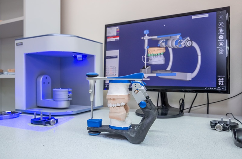 Dental articulator and 3D scanner in modern dental lab